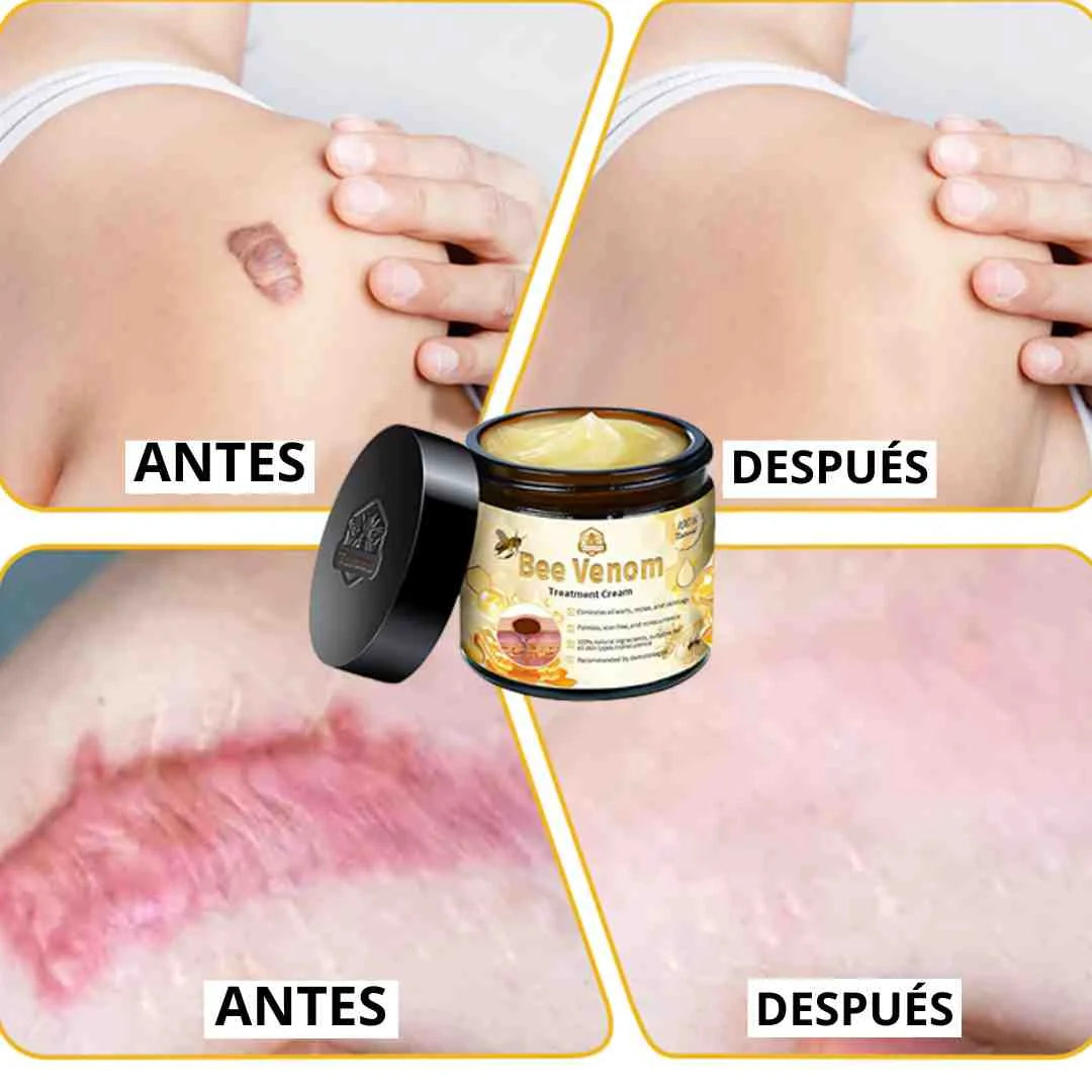 Crema De Veneno de Abejas